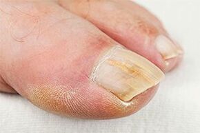 Zemlja -Finger