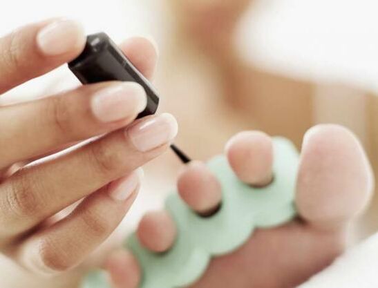 zdravljenje nohtov z lakom za nohte zaradi glivične okužbe