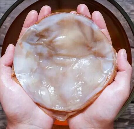 glivice na nohtih kombucha